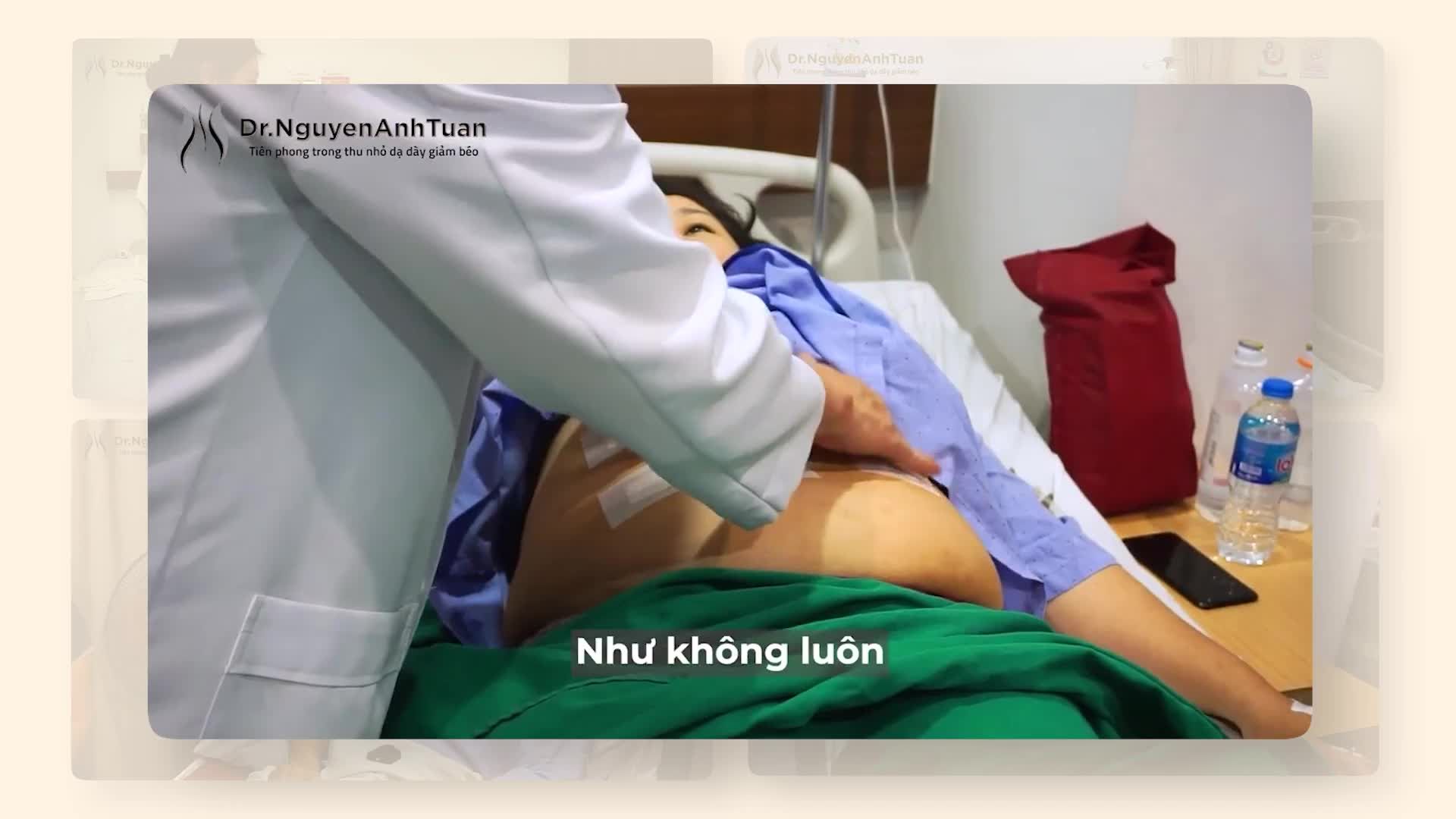 Thu nhỏ dạ dày điều trị béo phì được thực hiện hoàn toàn bằng phương pháp phẫu thuật nội soi.